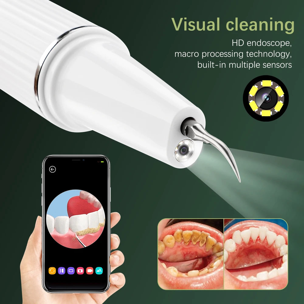 Détartreur de calcul dentaire visuel ultrasonique, nettoyeur de dents buccales