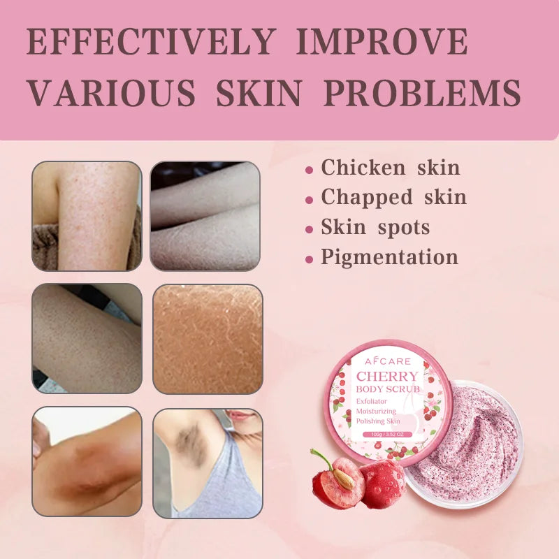 Exfoliant corporel cerise, nettoyage en profondeur, hydratant, Niacinamide, blanchissant, améliore la peau de poulet craquelée, crème exfoliante