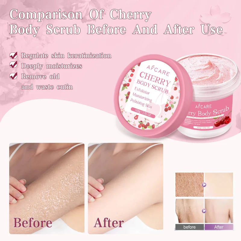 Exfoliant corporel cerise, nettoyage en profondeur, hydratant, Niacinamide, blanchissant, améliore la peau de poulet craquelée, crème exfoliante