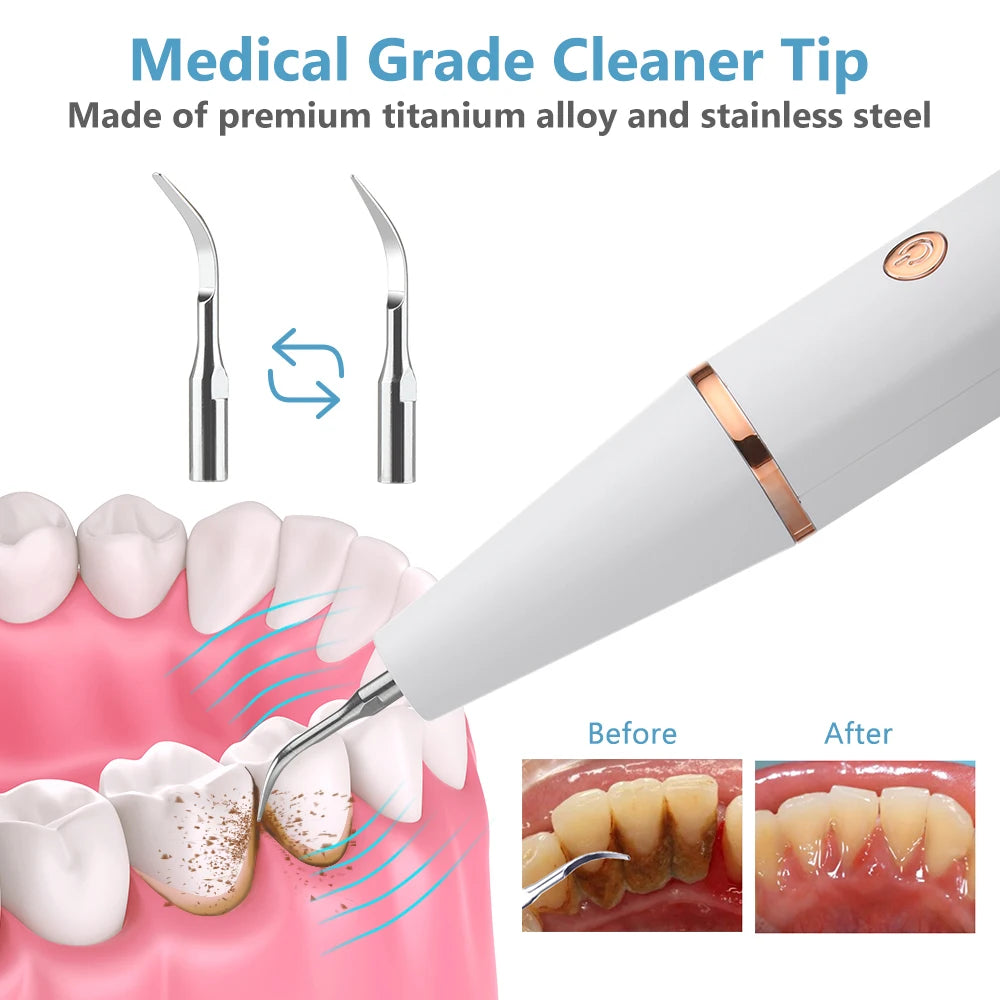 Détartreur dentaire à ultrasons, nettoyeur de dents