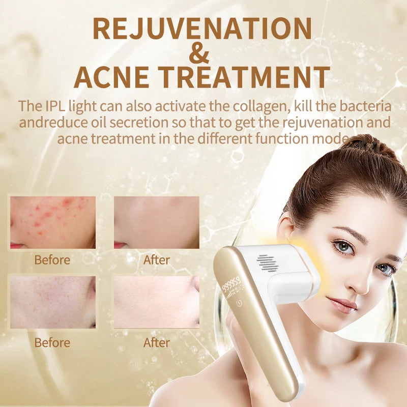 Épilateur Laser IPL 3 en 1 pour femmes et hommes, rasoir, traitement de l'acné, à la maison, Bikini, tondeuse, livraison directe