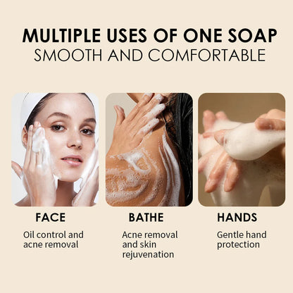 Savon au curcuma, acides au citron, fait à la main, acide kojique, barre de soin naturelle pour hydrater et exfolier le corps et le visage, 5 pièces