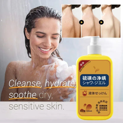 Savon liquide anti-acariens au soufre, Gel douche, nettoyage en profondeur, nettoyant pour tout le corps, acné, lavage du corps, 320ml
