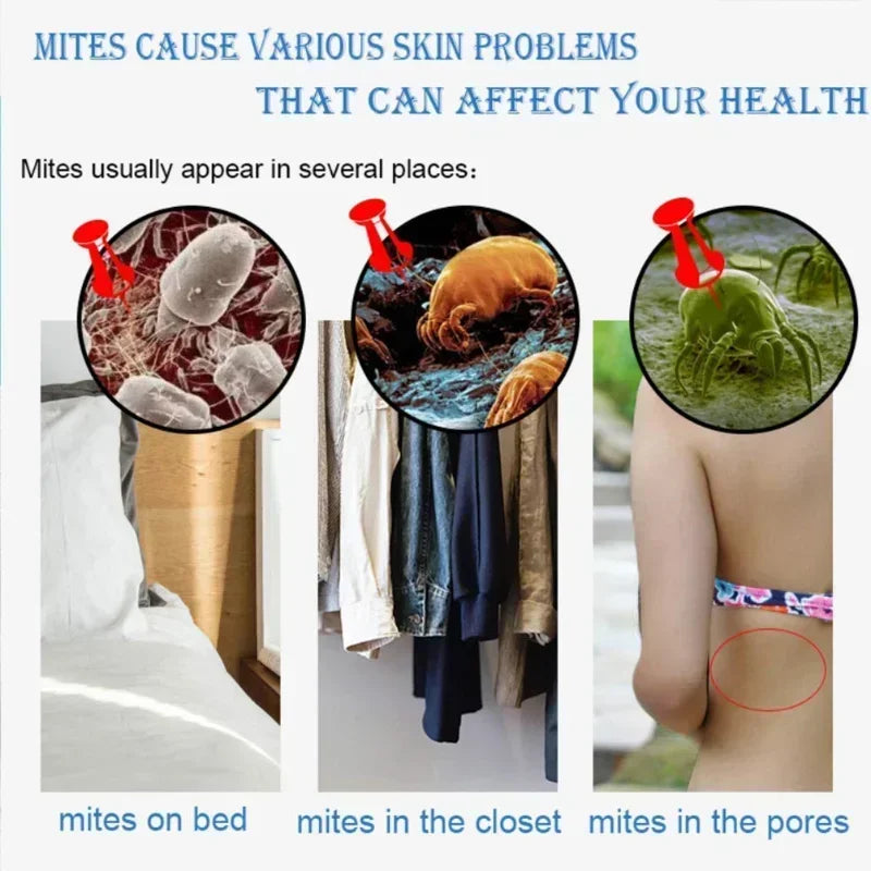 Savon liquide anti-acariens au soufre, Gel douche, nettoyage en profondeur, nettoyant pour tout le corps, acné, lavage du corps, 320ml