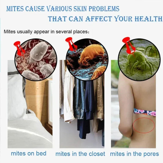 Savon liquide anti-acariens au soufre, Gel douche, nettoyage en profondeur, nettoyant pour tout le corps, acné, lavage du corps, 320ml