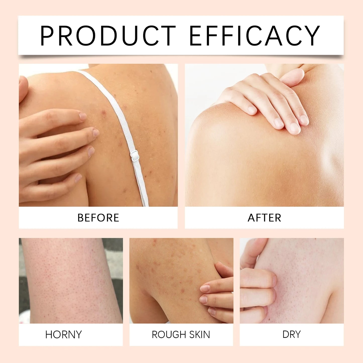 Gel douche blanchissant au papaye, exfoliant, estompe, Pigmentation, arôme durable, huile de contrôle rafraîchissante, mousse riche, lavage du corps