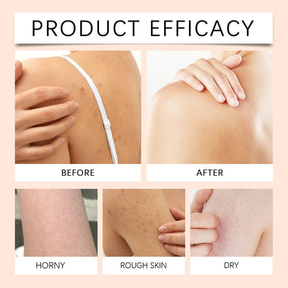 Gel douche blanchissant au papaye, exfoliant, estompe, Pigmentation, arôme durable, huile de contrôle rafraîchissante, mousse riche, lavage du corps