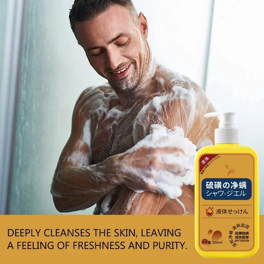 Savon liquide anti-acariens au soufre, Gel douche, nettoyage en profondeur, nettoyant pour tout le corps, acné, lavage du corps, 320ml