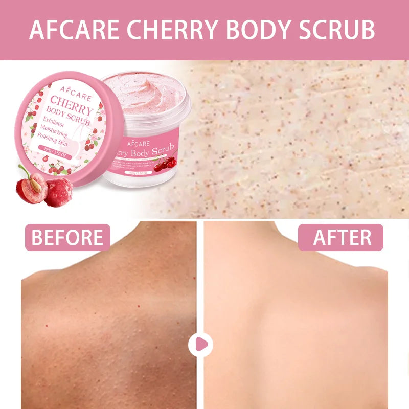 Exfoliant corporel cerise, nettoyage en profondeur, hydratant, Niacinamide, blanchissant, améliore la peau de poulet craquelée, crème exfoliante