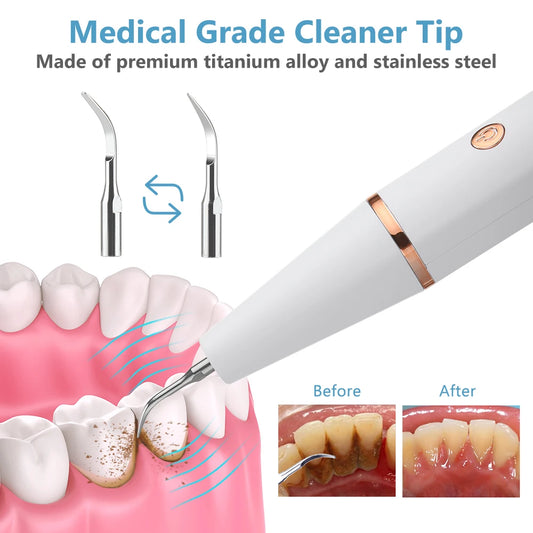 Détartreur dentaire à ultrasons, nettoyeur de dents